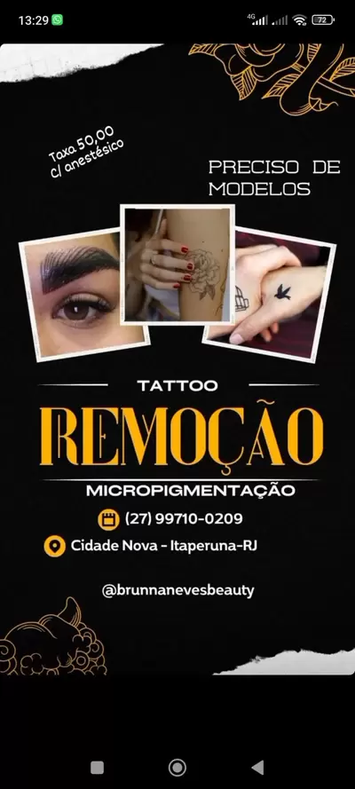 Despigmentação de sobrancelhas-tatuagem