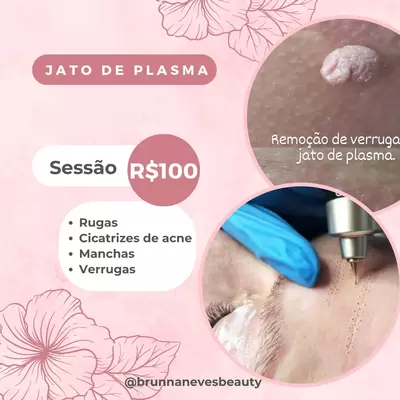 Jato de plasma